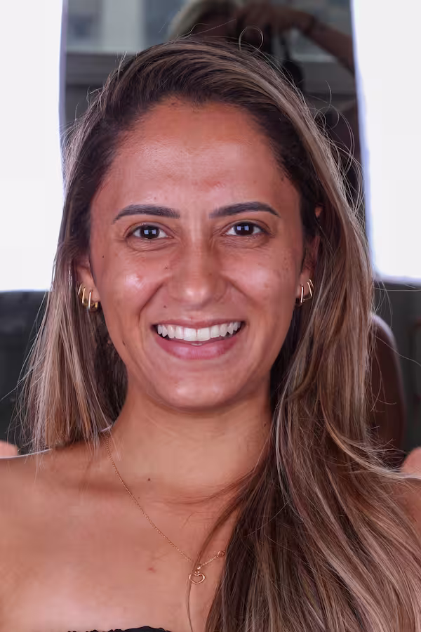 Antes, sorriso da paciente antes das lentes de contato em resina